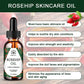 Gua Sha Massage Tools & Rosehip Oil In One Set, 